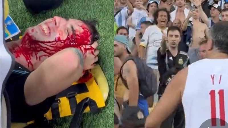 Entrerriano fue por primera vez a ver a Argentina y lo golpearon brutalmente