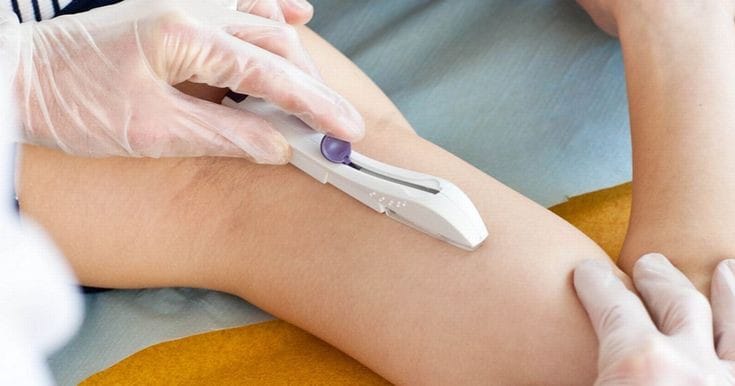 Inscriben para la colocación gratuita de implantes subdérmicos en el CIC de Villa del Rosario