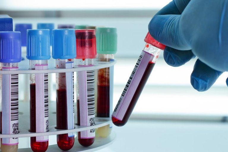 Bioquímicos suspendieron la prestación de servicios a afiliados de Iosper