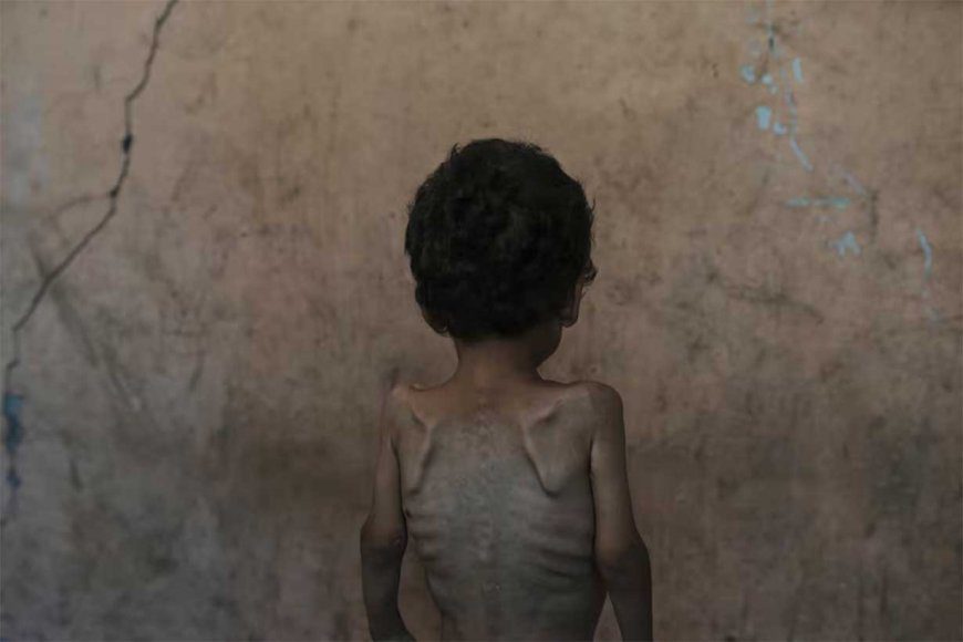 “Morir en Gaza”, la columna escrita por un exobispo en Entre Ríos, que describe y denuncia un “exterminio sistemático”