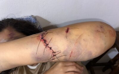 De «gresca familiar» a intento de homicidio: El tremendo caso de la enfermera de Santa Ana atacada con un hacha