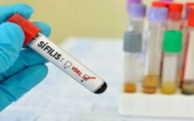 Los casos confirmados de sífilis en Entre Ríos crecieron más del 65% en el último año