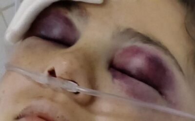Misterio y preocupación: una joven universitaria fue hallada gravemente herida en una avenida de Concordia y buscan testigos